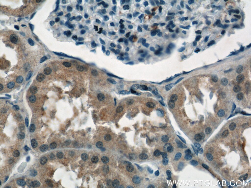 Immunohistochemistry (IHC) staining of human kidney tissue using NPLOC4 Polyclonal antibody (11638-1-AP)