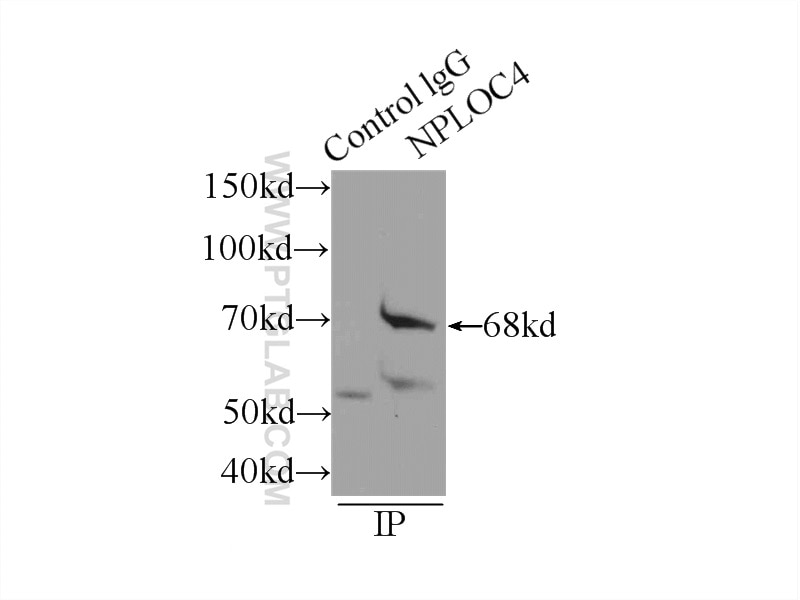 Immunoprecipitation (IP) experiment of mouse kidney tissue using NPLOC4 Polyclonal antibody (11638-1-AP)