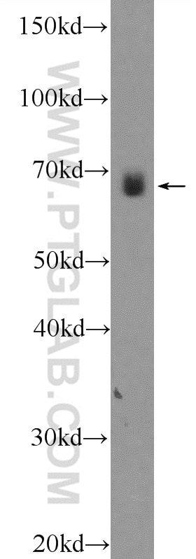 Western Blot (WB) analysis of rat heart tissue using NPLOC4 Polyclonal antibody (11638-1-AP)