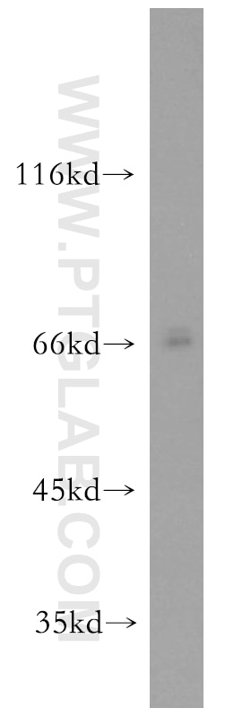 Western Blot (WB) analysis of mouse heart tissue using NPLOC4 Polyclonal antibody (11638-1-AP)