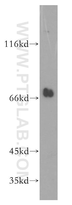 Western Blot (WB) analysis of mouse kidney tissue using NPLOC4 Polyclonal antibody (11638-1-AP)