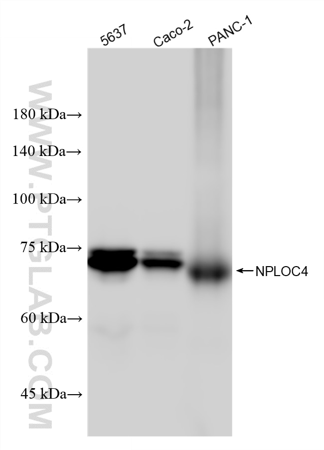Western Blot (WB) analysis of various lysates using NPLOC4 Recombinant monoclonal antibody (87535-4-RR)