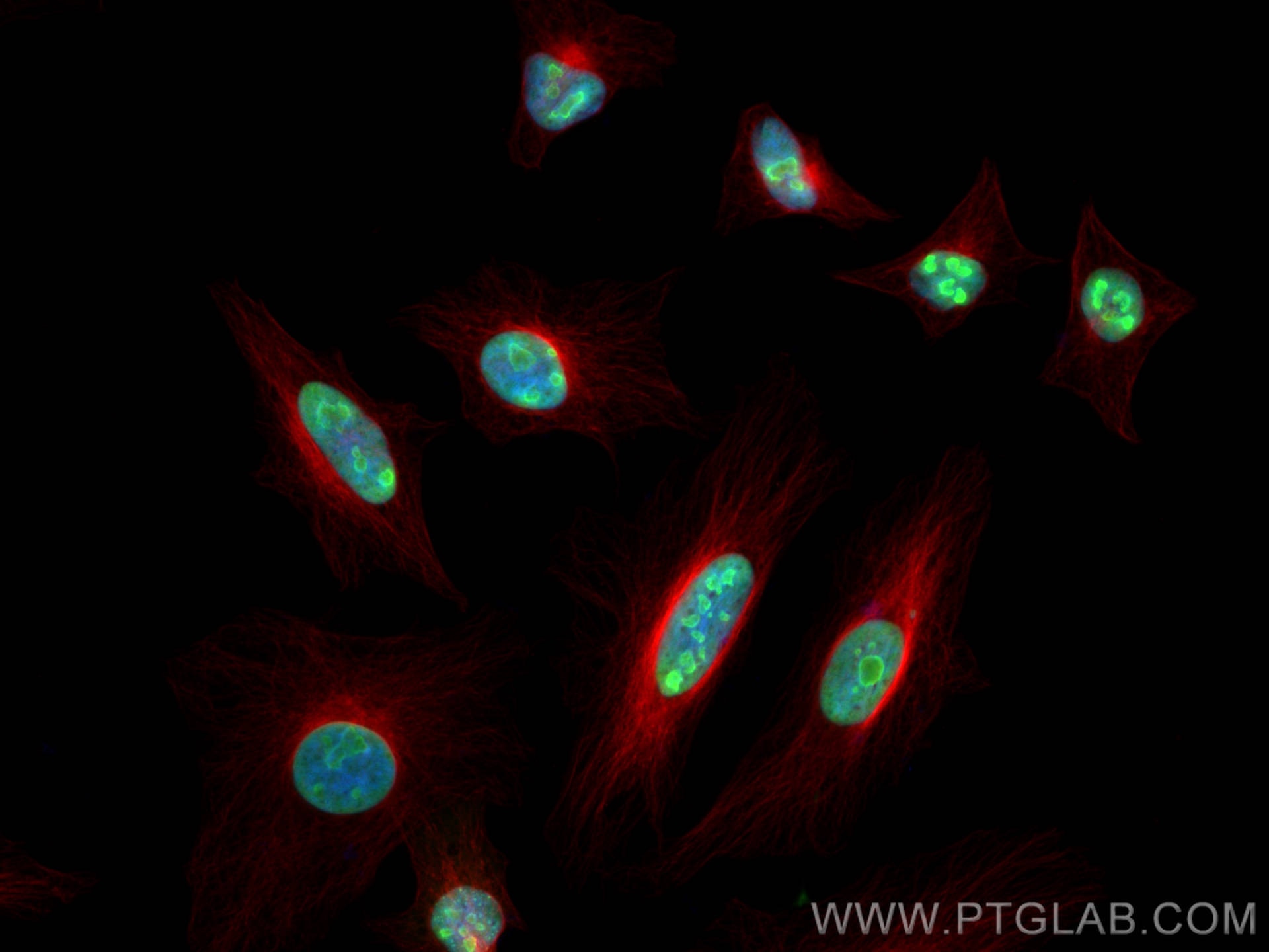 Immunofluorescence (IF) / fluorescent staining of HeLa cells using B23/NPM1 Polyclonal antibody (10306-1-AP)