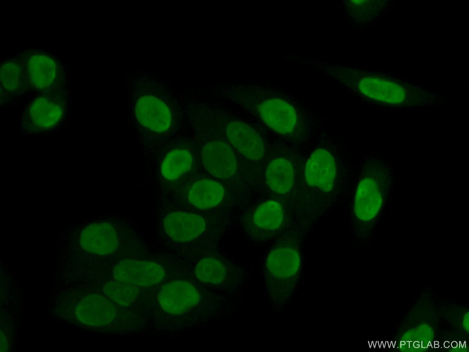 Immunofluorescence (IF) / fluorescent staining of HeLa cells using B23/NPM1 Polyclonal antibody (10306-1-AP)