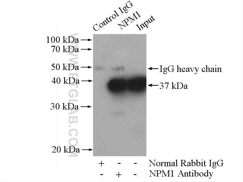 Immunoprecipitation (IP) experiment of Jurkat cells using B23/NPM1 Polyclonal antibody (10306-1-AP)