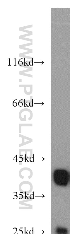 WB analysis of K-562 using 10306-1-AP