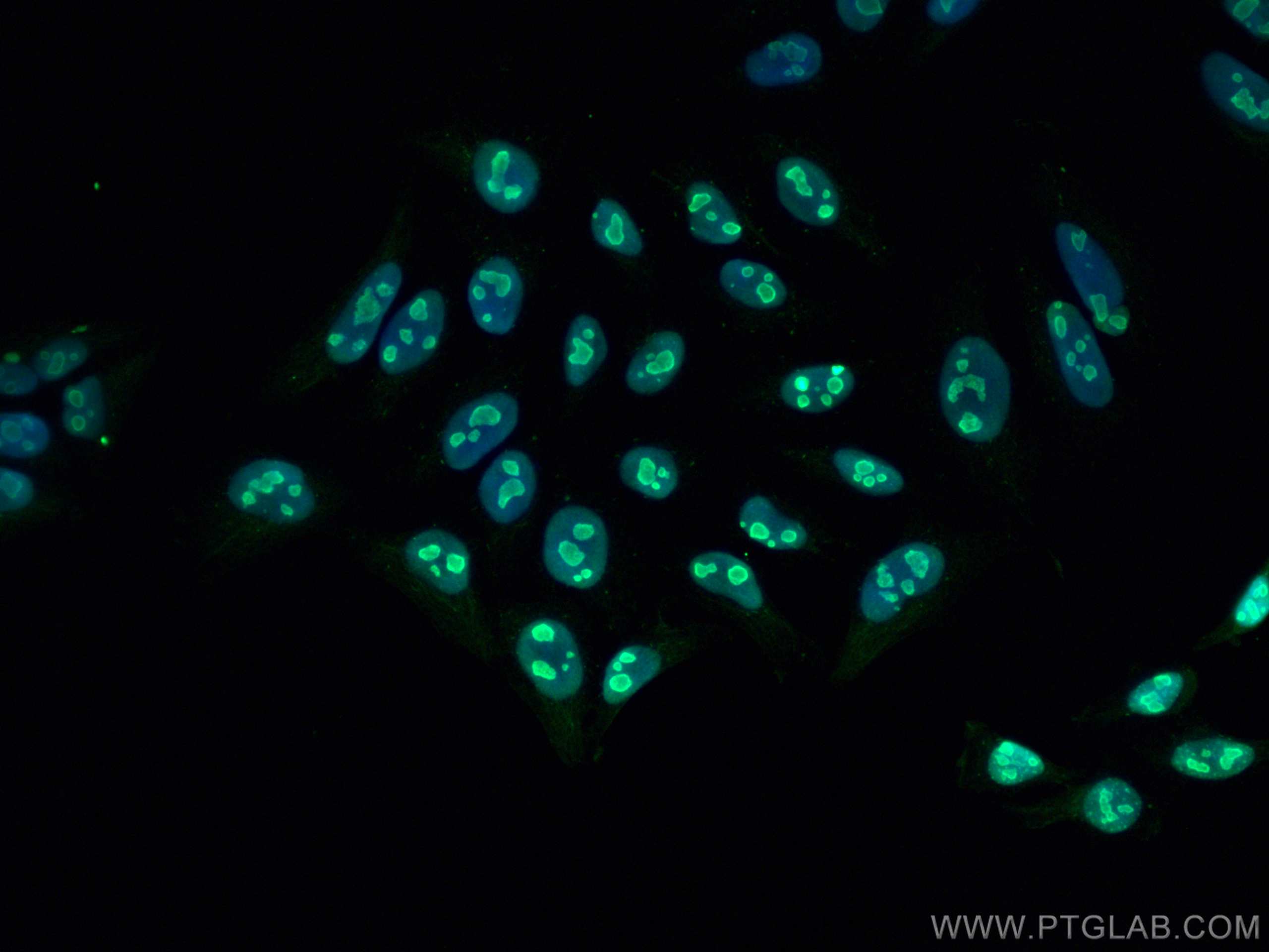 Immunofluorescence (IF) / fluorescent staining of HepG2 cells using B23/NPM1 Monoclonal antibody (60096-1-Ig)
