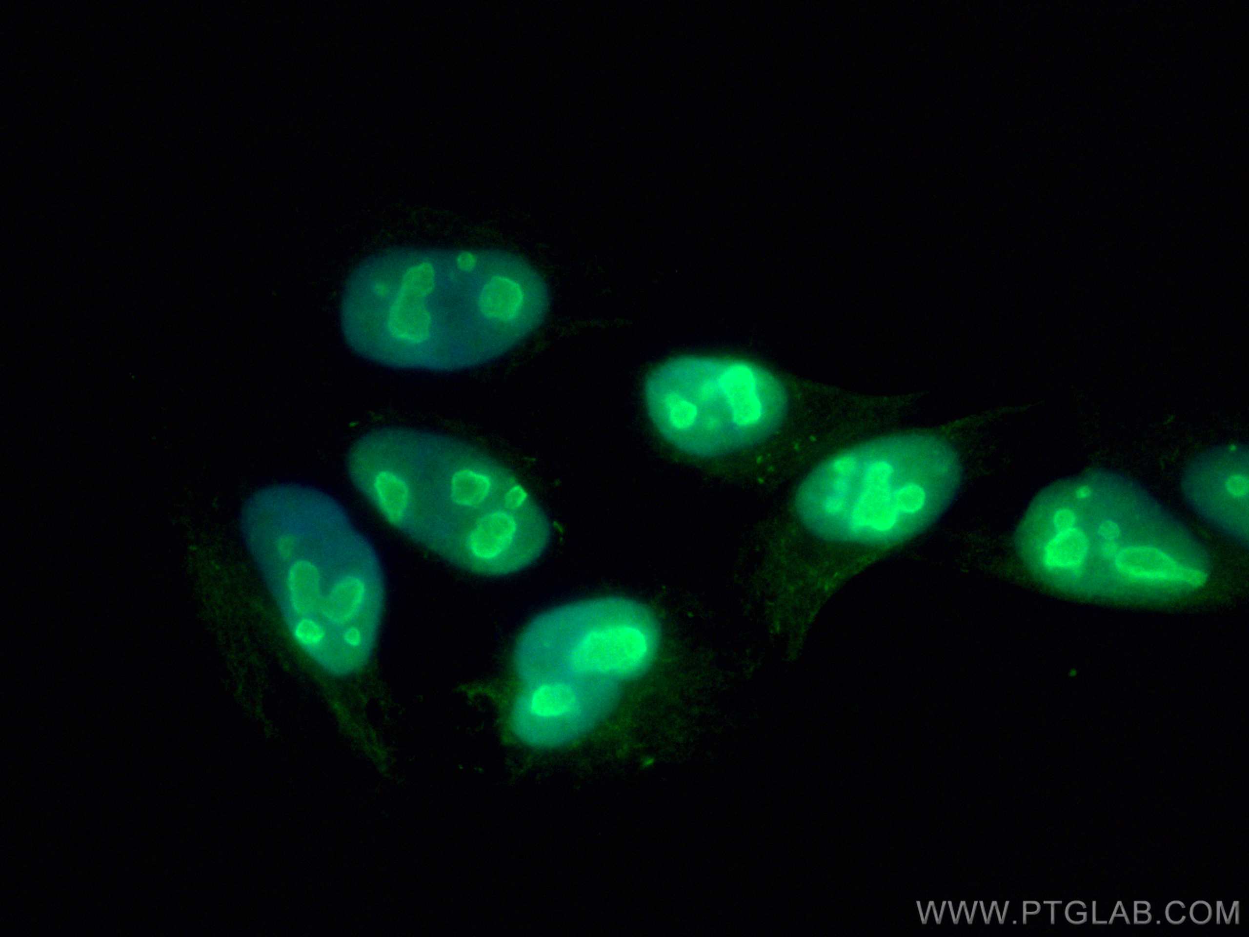 Immunofluorescence (IF) / fluorescent staining of HepG2 cells using B23/NPM1 Monoclonal antibody (60096-1-Ig)