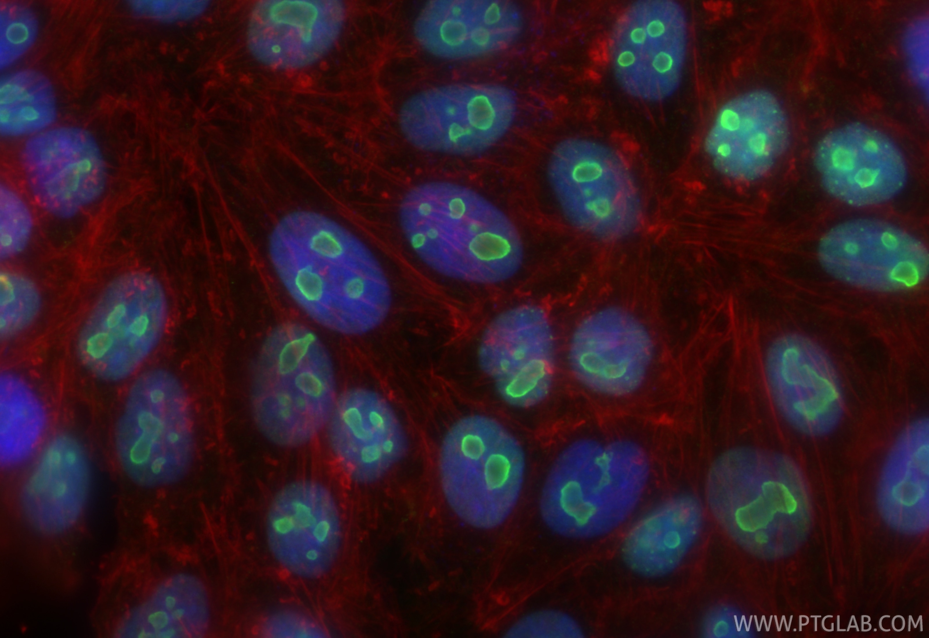 Immunofluorescence (IF) / fluorescent staining of HepG2 cells using B23/NPM1 Monoclonal antibody (60096-1-Ig)