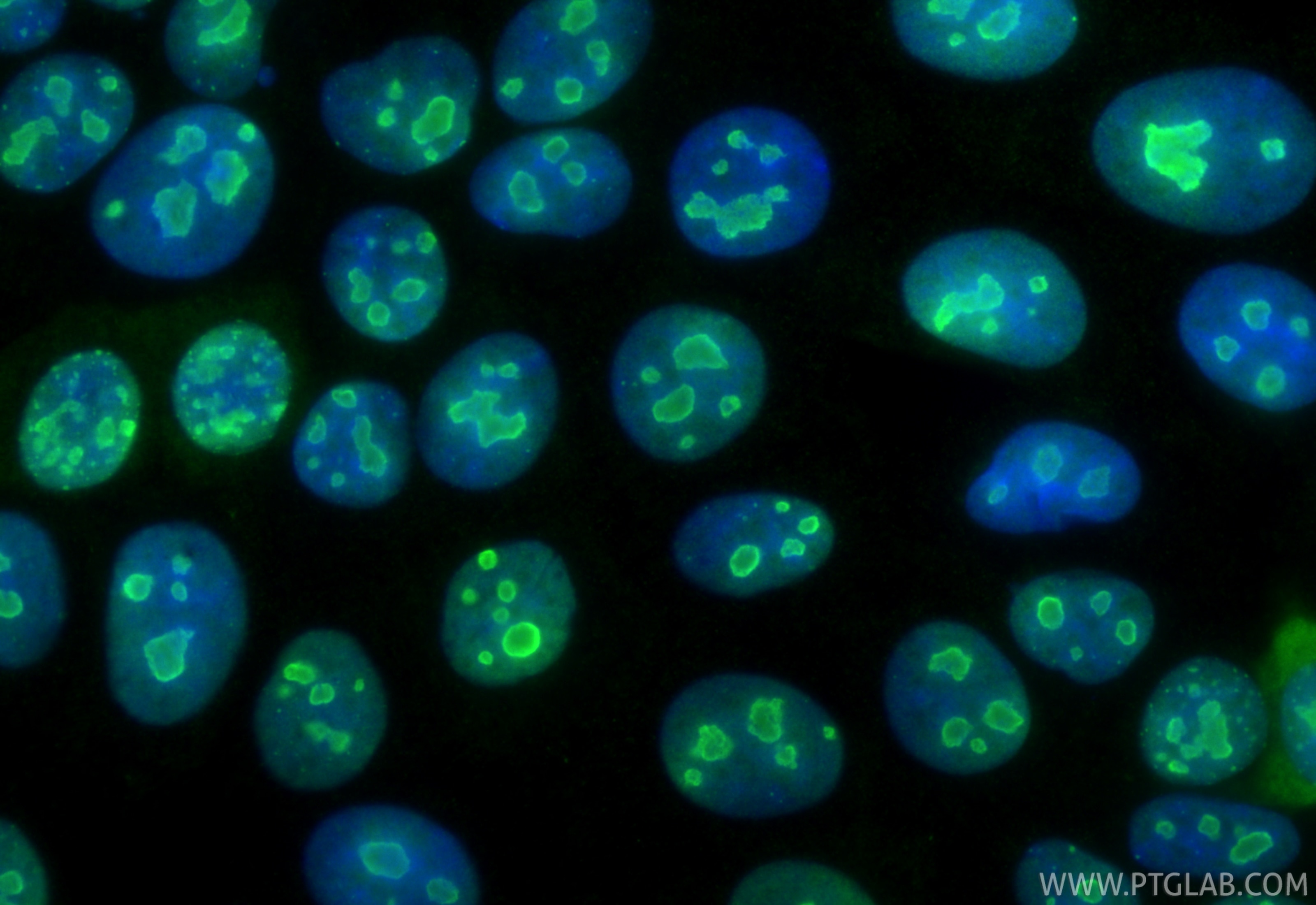 Immunofluorescence (IF) / fluorescent staining of MCF-7 cells using B23/NPM1 Monoclonal antibody (60096-1-Ig)