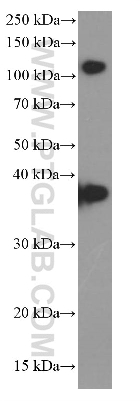 Western Blot (WB) analysis of NIH/3T3 cells using B23/NPM1 Monoclonal antibody (60096-1-Ig)