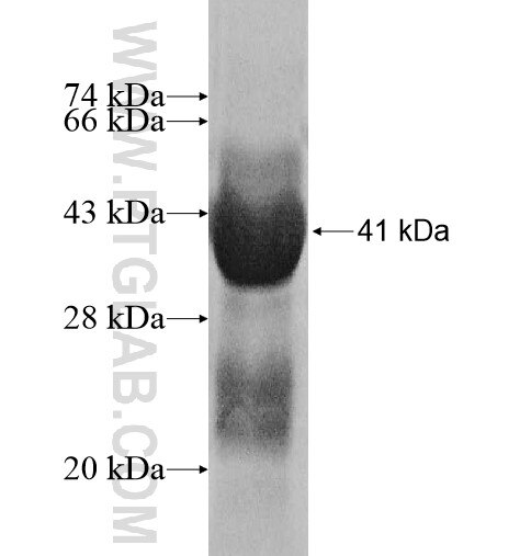 NPM2 fusion protein Ag10281 SDS-PAGE