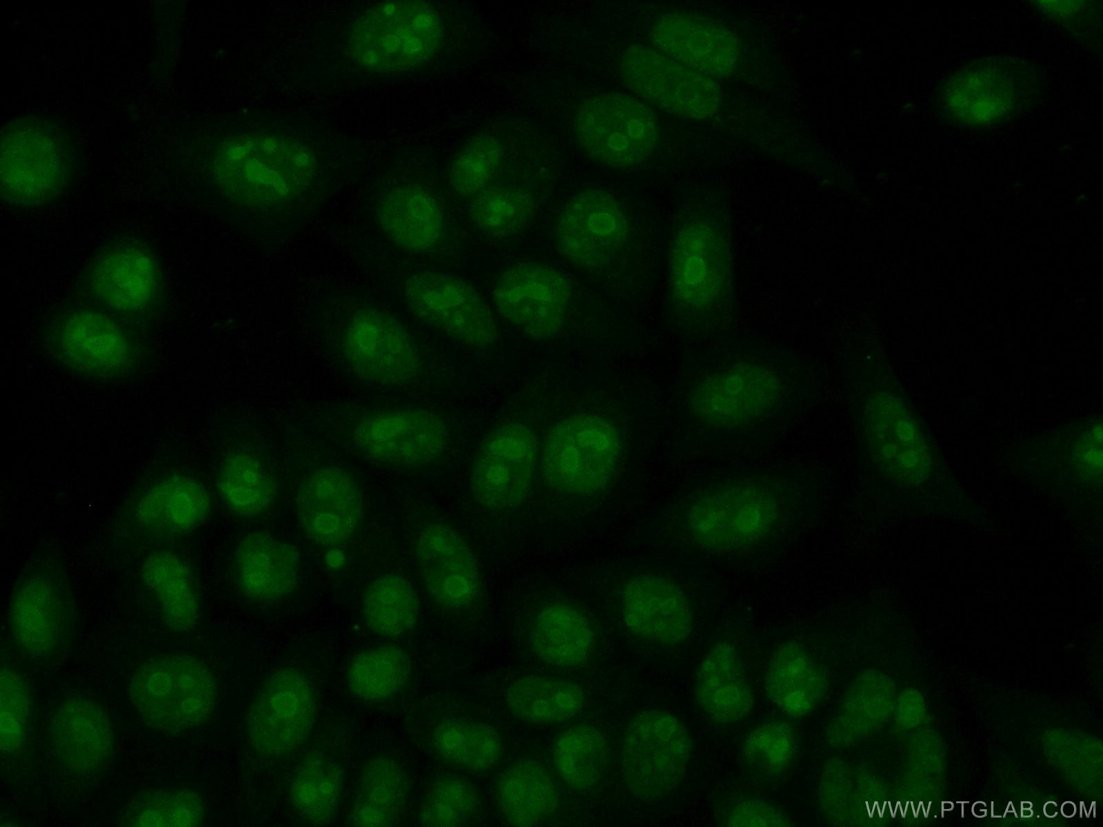 Immunofluorescence (IF) / fluorescent staining of HeLa cells using NPM3 Polyclonal antibody (11960-1-AP)