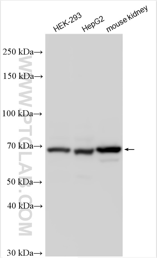 Western Blot (WB) analysis of various lysates using NPNT Polyclonal antibody (30836-1-AP)
