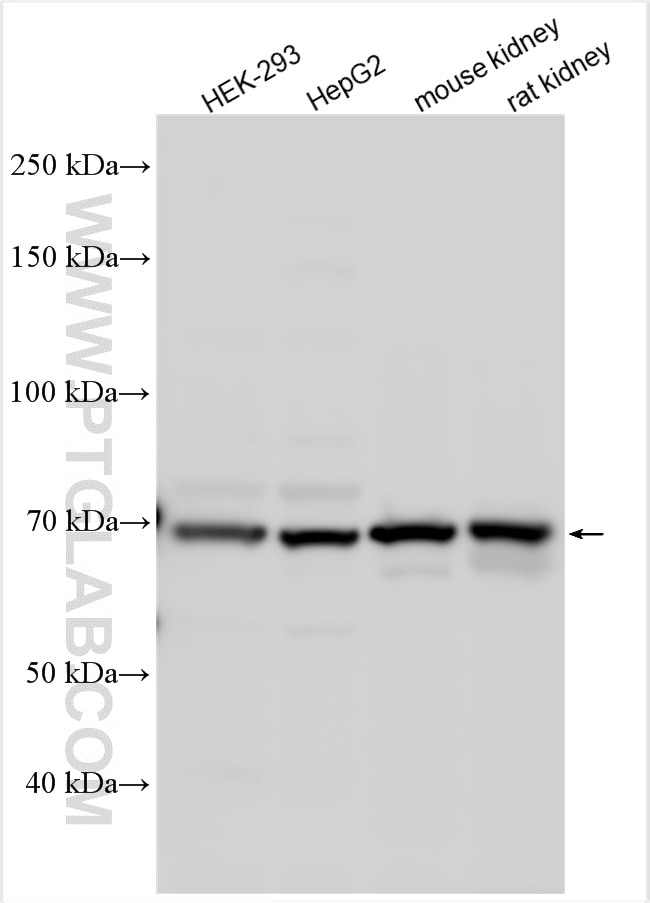Western Blot (WB) analysis of various lysates using NPNT Polyclonal antibody (30836-1-AP)