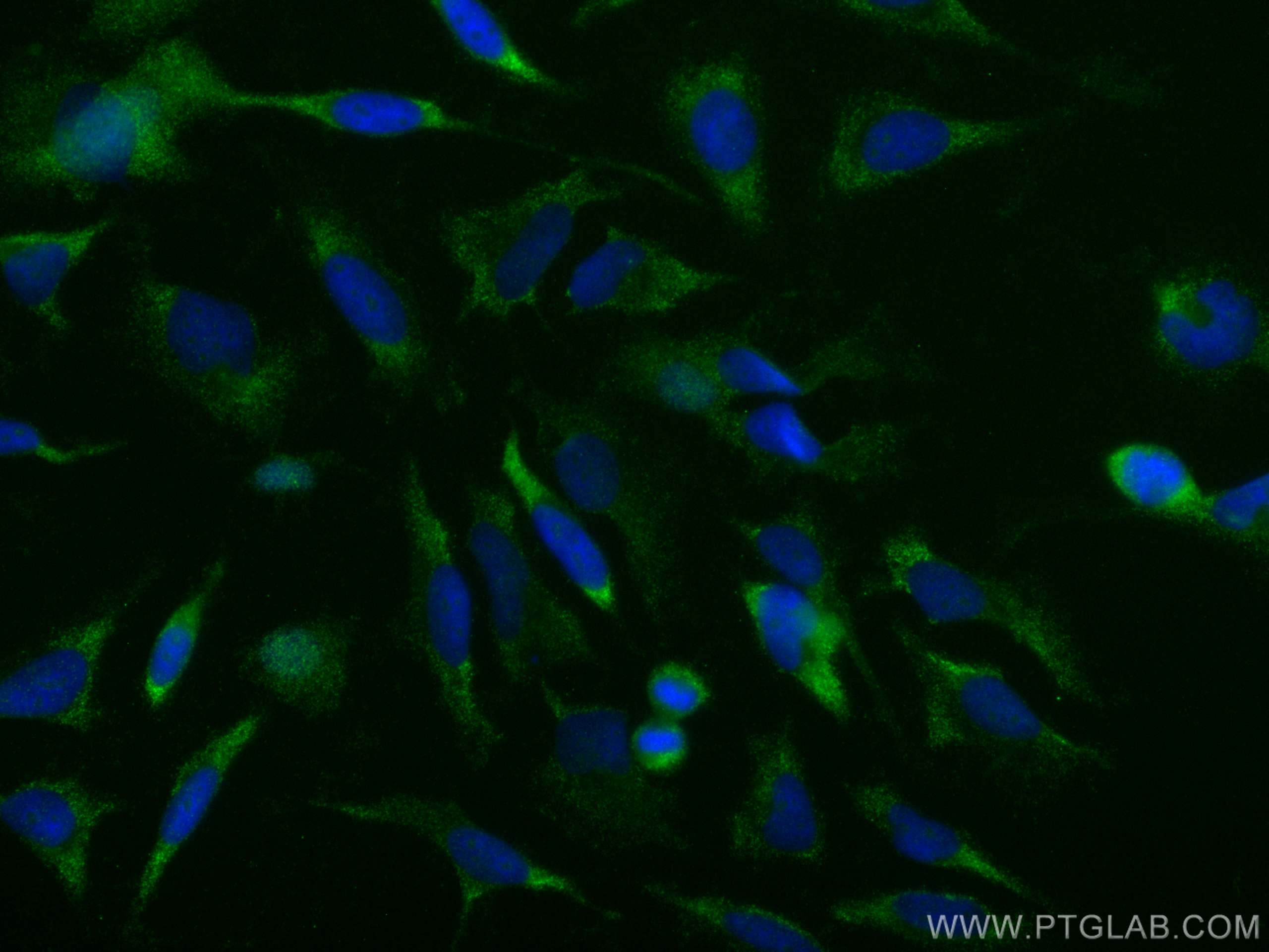 Immunofluorescence (IF) / fluorescent staining of HeLa cells using NPPA Polyclonal antibody (27426-1-AP)