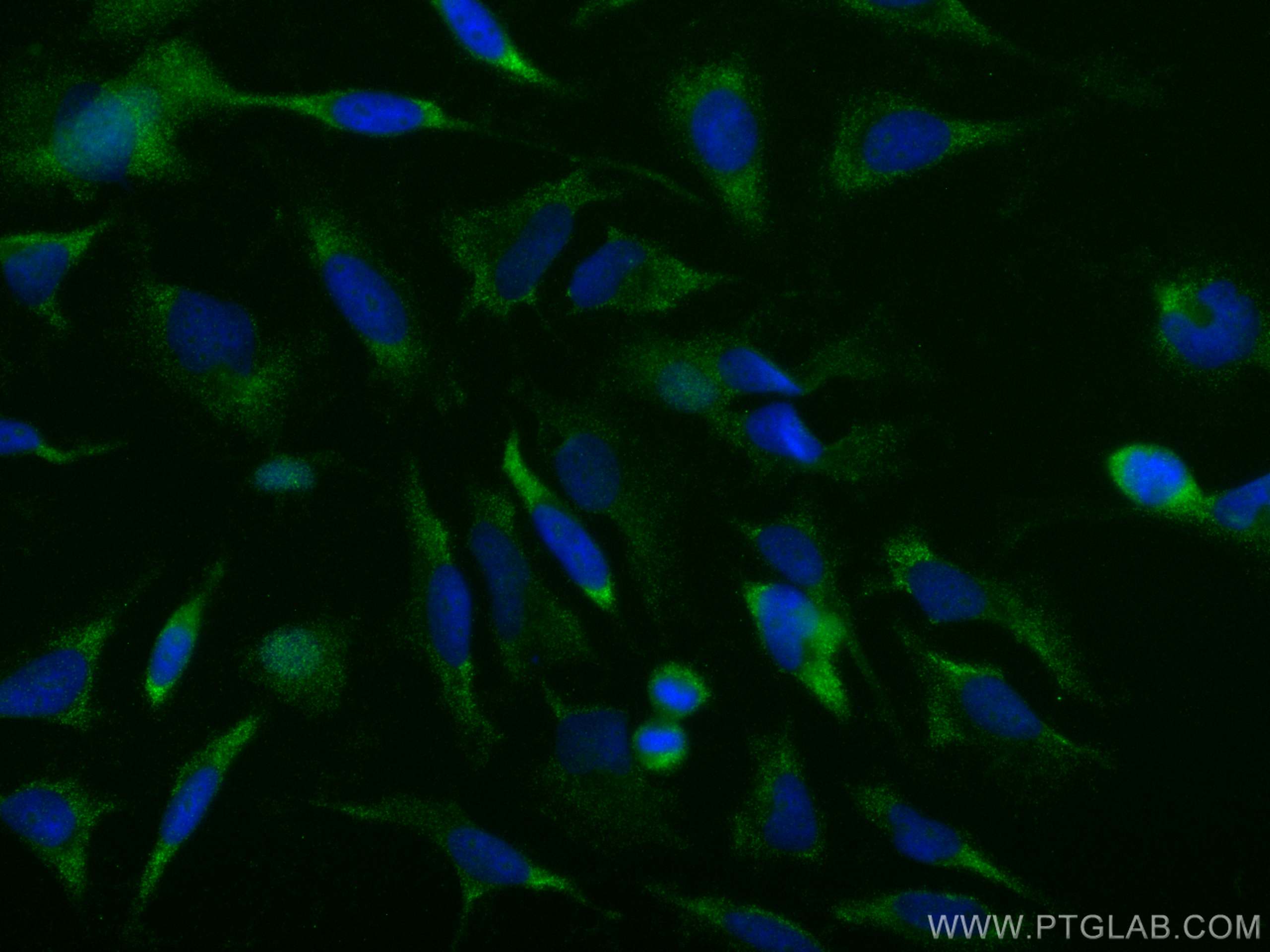 IF Staining of HeLa using 27426-1-AP