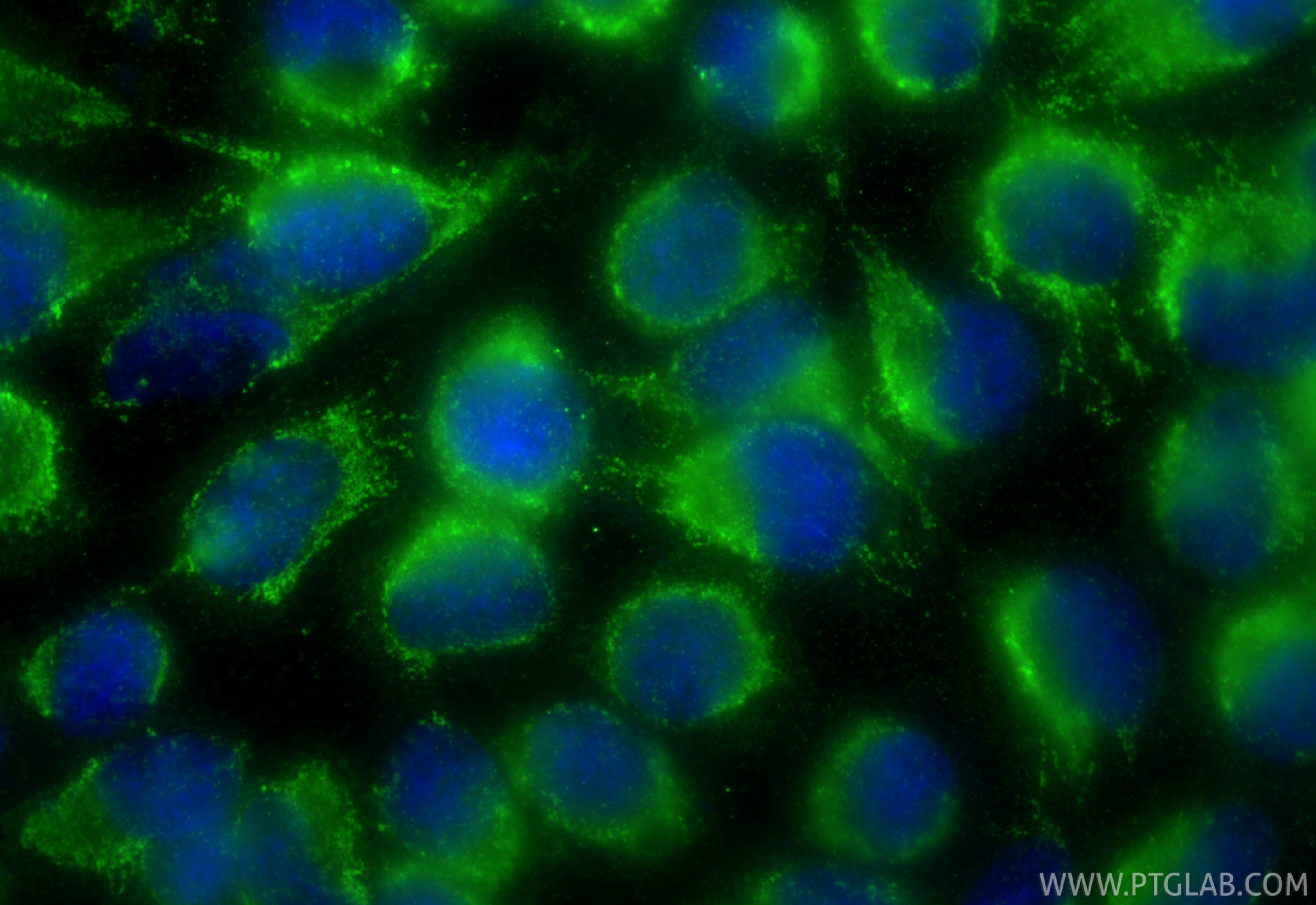 Immunofluorescence (IF) / fluorescent staining of HeLa cells using NPPA Polyclonal antibody (27426-1-AP)
