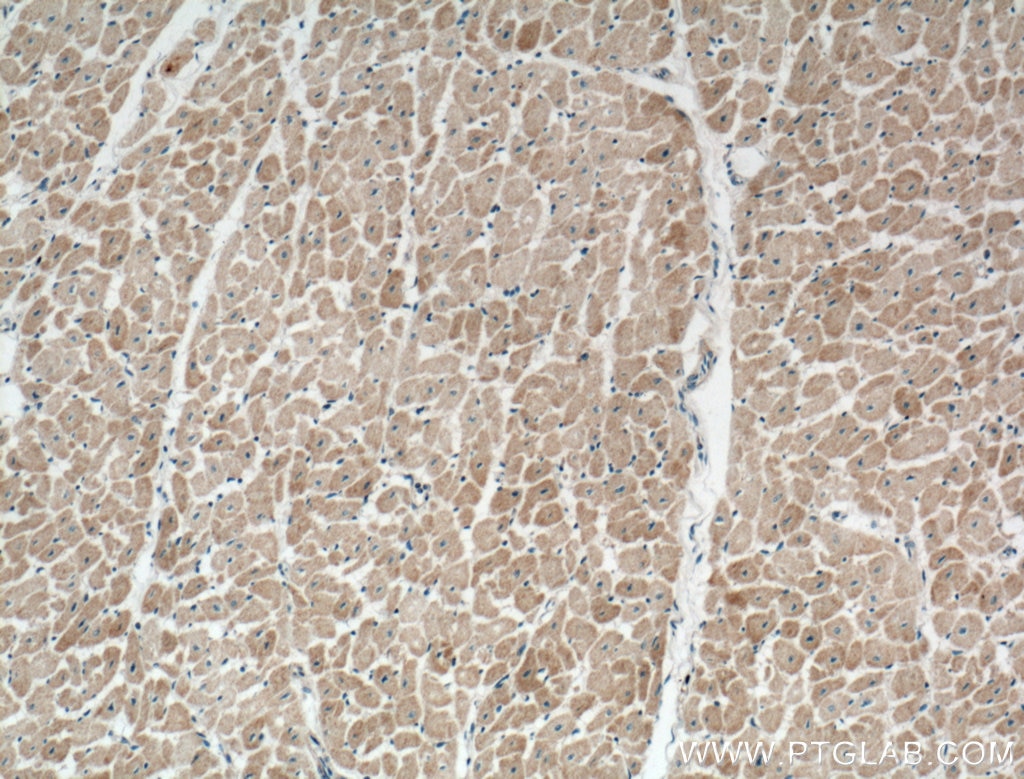 Immunohistochemistry (IHC) staining of human heart tissue using NPPA Polyclonal antibody (27426-1-AP)