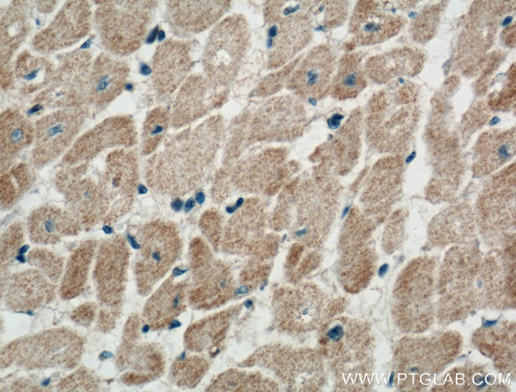 Immunohistochemistry (IHC) staining of human heart tissue using NPPA Polyclonal antibody (27426-1-AP)