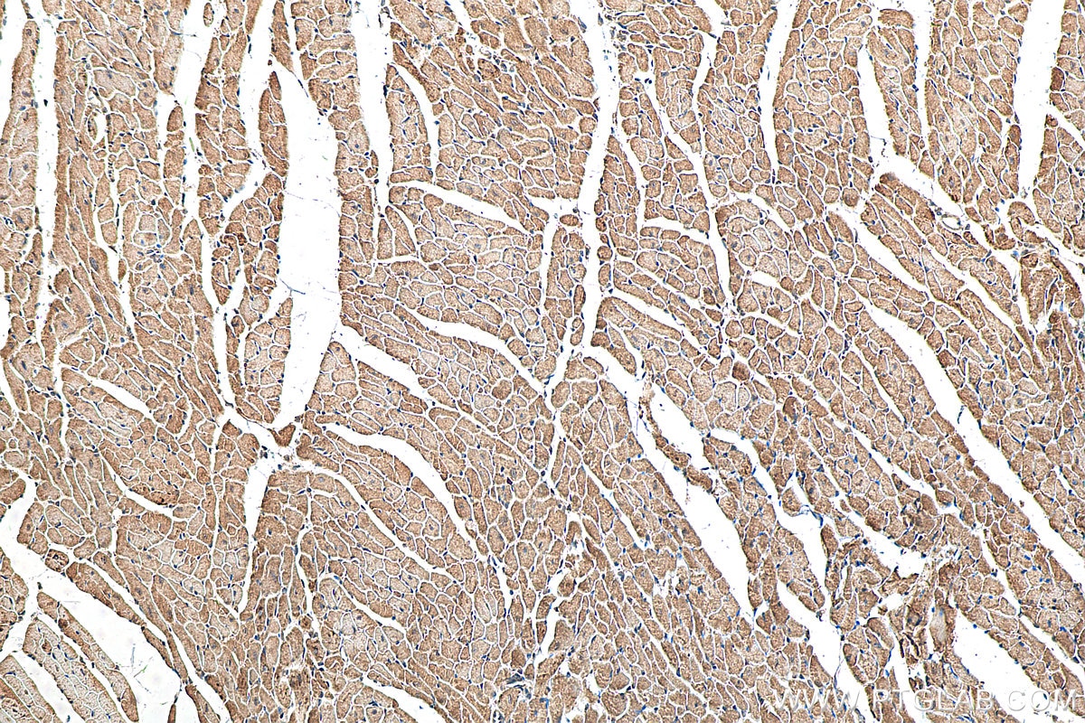 IHC staining of mouse heart using 27426-1-AP