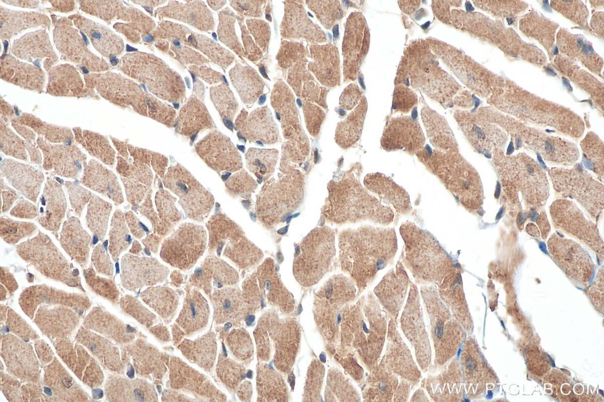 Immunohistochemistry (IHC) staining of mouse heart tissue using NPPA Polyclonal antibody (27426-1-AP)
