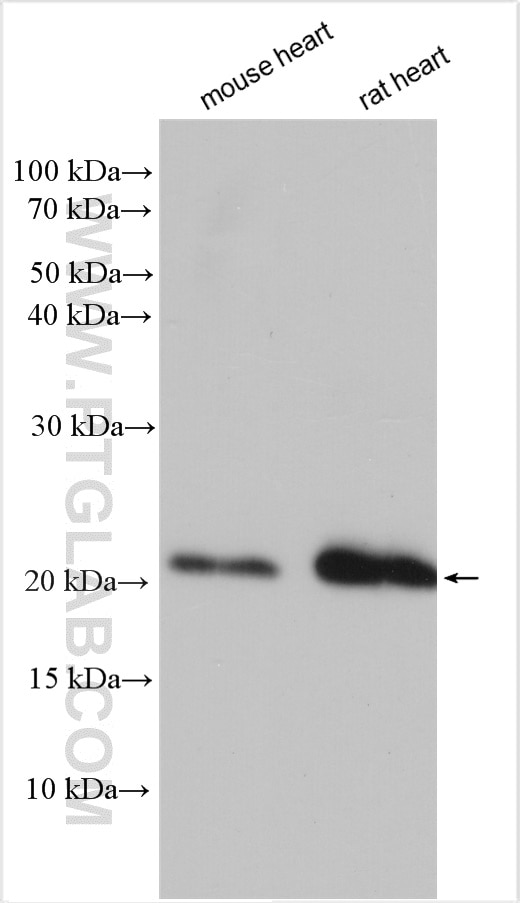 Western Blot (WB) analysis of various lysates using NPPA Polyclonal antibody (27426-1-AP)