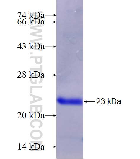 NPPA fusion protein Ag27058 SDS-PAGE
