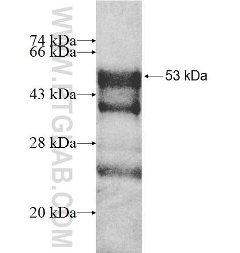 NPPA fusion protein Ag8503 SDS-PAGE