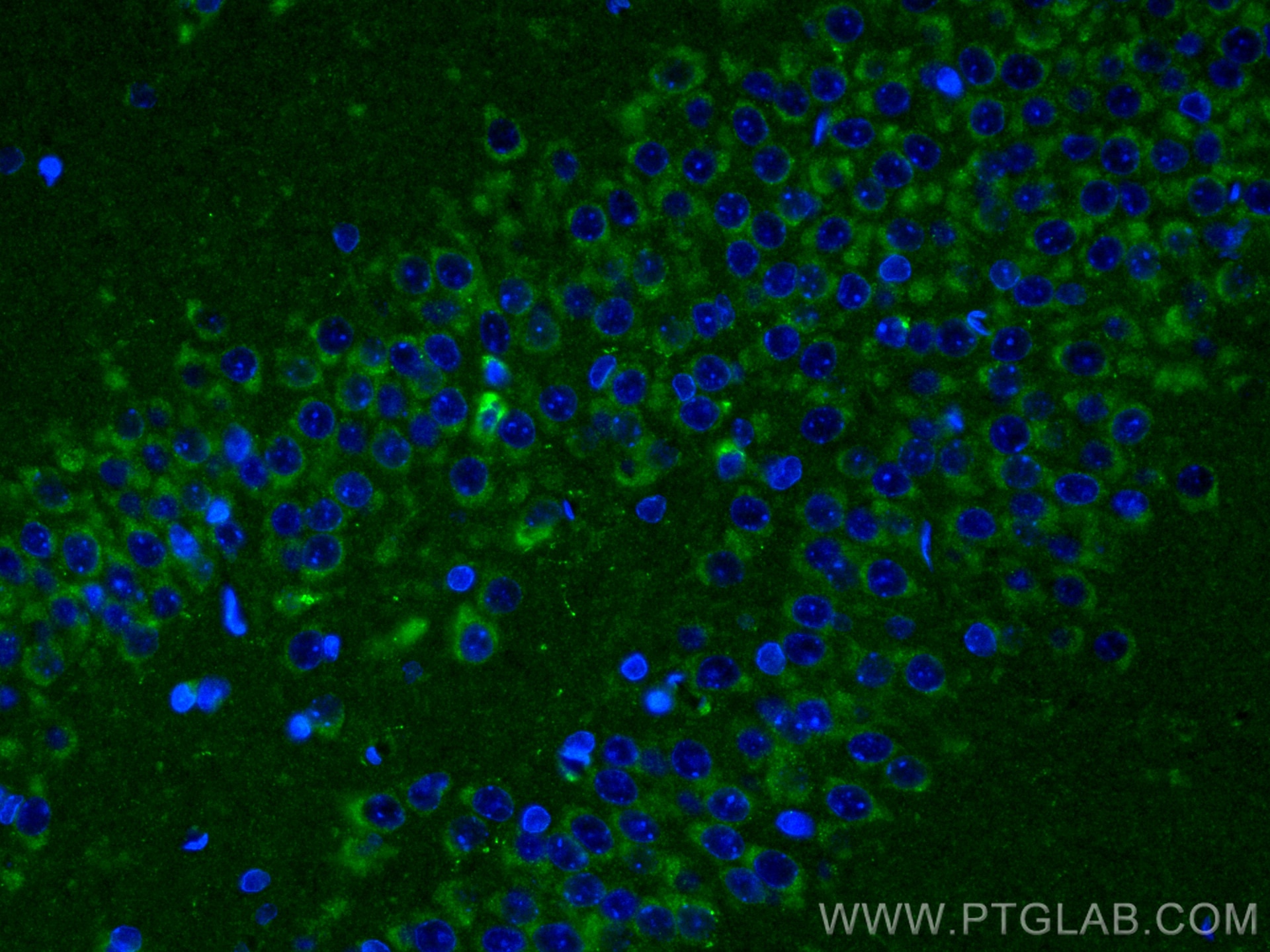 Immunofluorescence (IF) / fluorescent staining of rat brain tissue using BNP Polyclonal antibody (13299-1-AP)