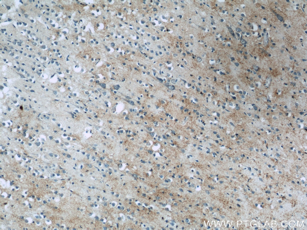 Immunohistochemistry (IHC) staining of human brain tissue using BNP Polyclonal antibody (13299-1-AP)