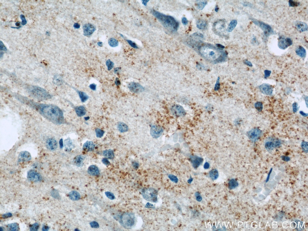 Immunohistochemistry (IHC) staining of human brain tissue using BNP Polyclonal antibody (13299-1-AP)