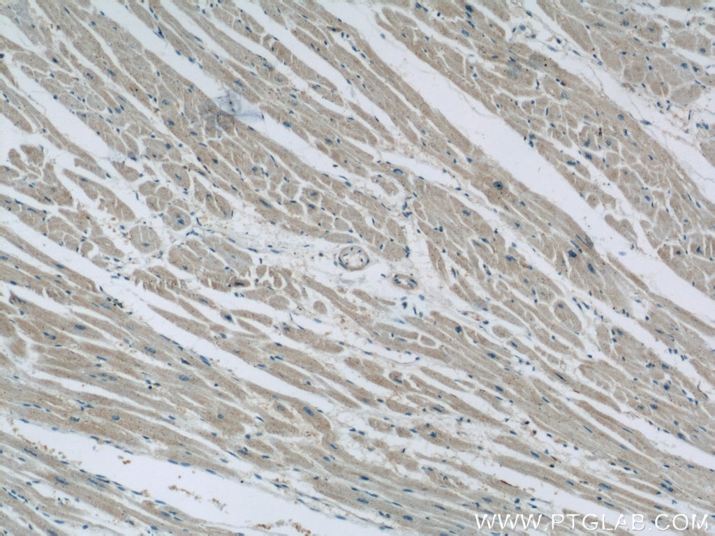 Immunohistochemistry (IHC) staining of human heart tissue using BNP Polyclonal antibody (13299-1-AP)