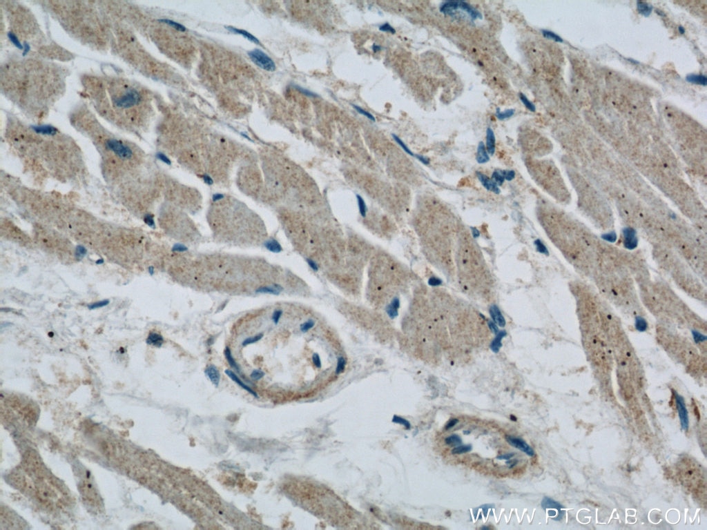 Immunohistochemistry (IHC) staining of human heart tissue using BNP Polyclonal antibody (13299-1-AP)