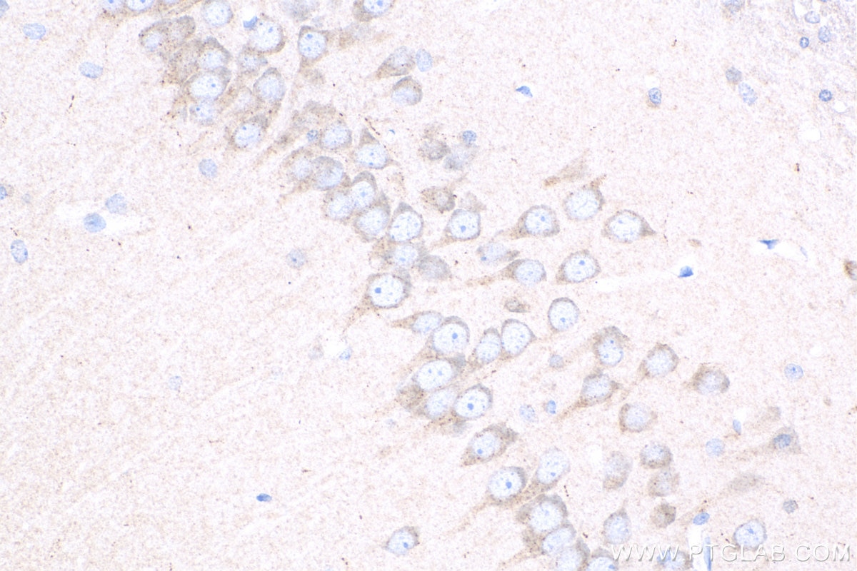 Immunohistochemistry (IHC) staining of rat brain tissue using BNP Polyclonal antibody (13299-1-AP)