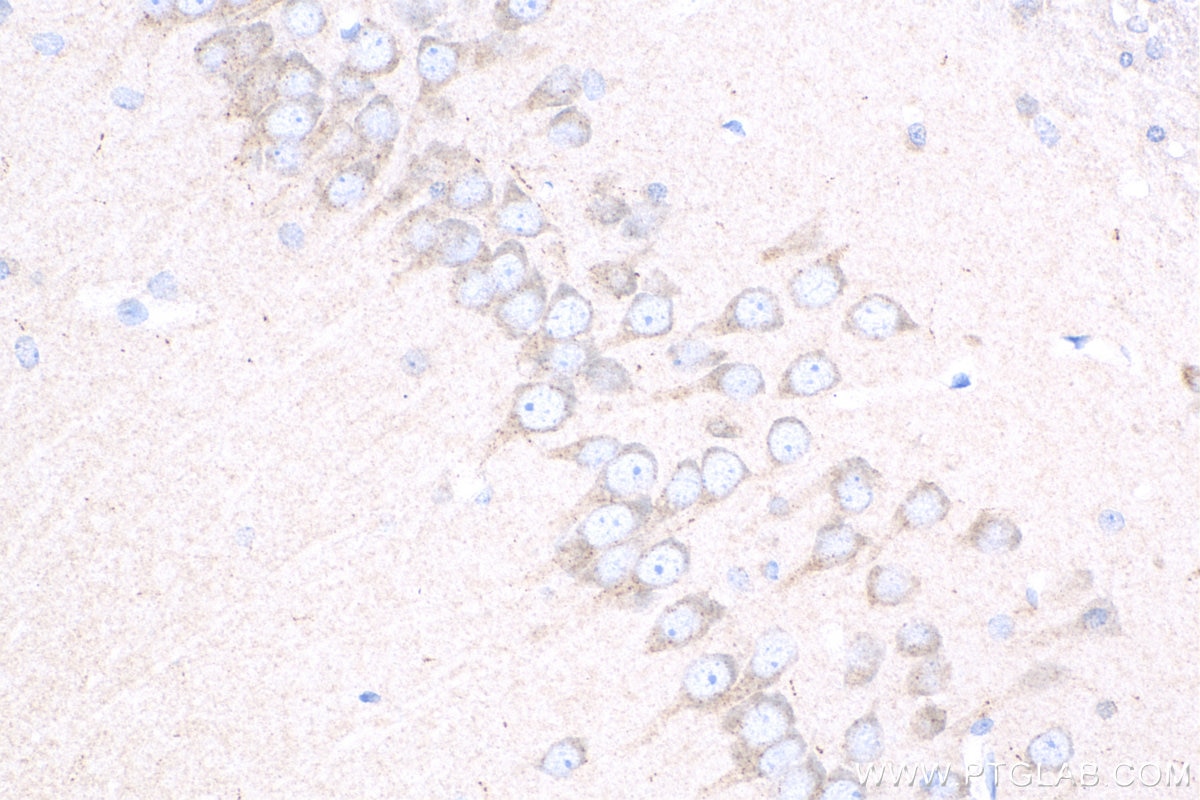 IHC staining of rat brain using 13299-1-AP