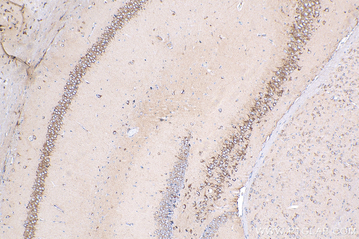 Immunohistochemistry (IHC) staining of mouse brain tissue using BNP Polyclonal antibody (13299-1-AP)