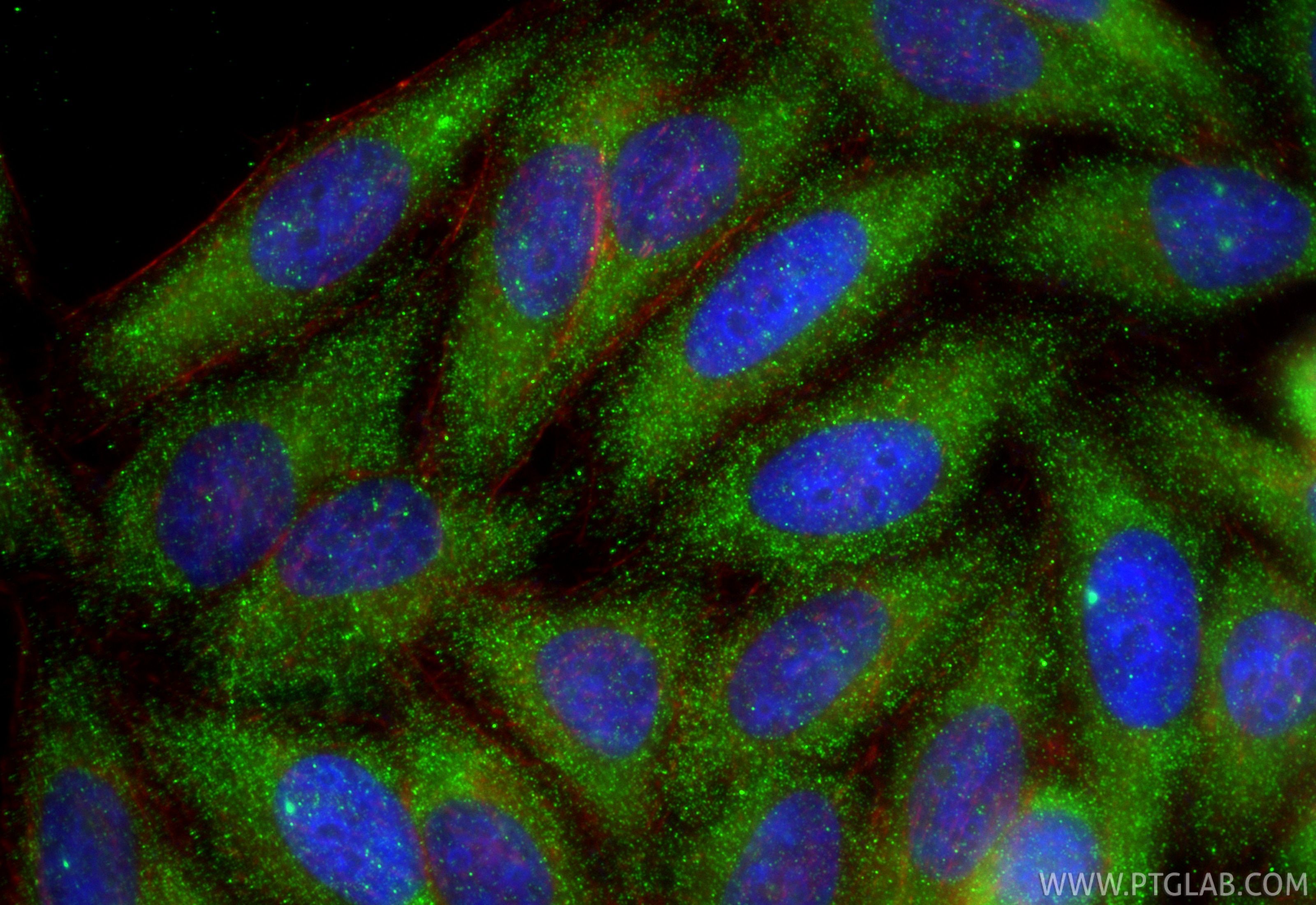 Immunofluorescence (IF) / fluorescent staining of HepG2 cells using BNP/NPPB Polyclonal antibody (28214-1-AP)