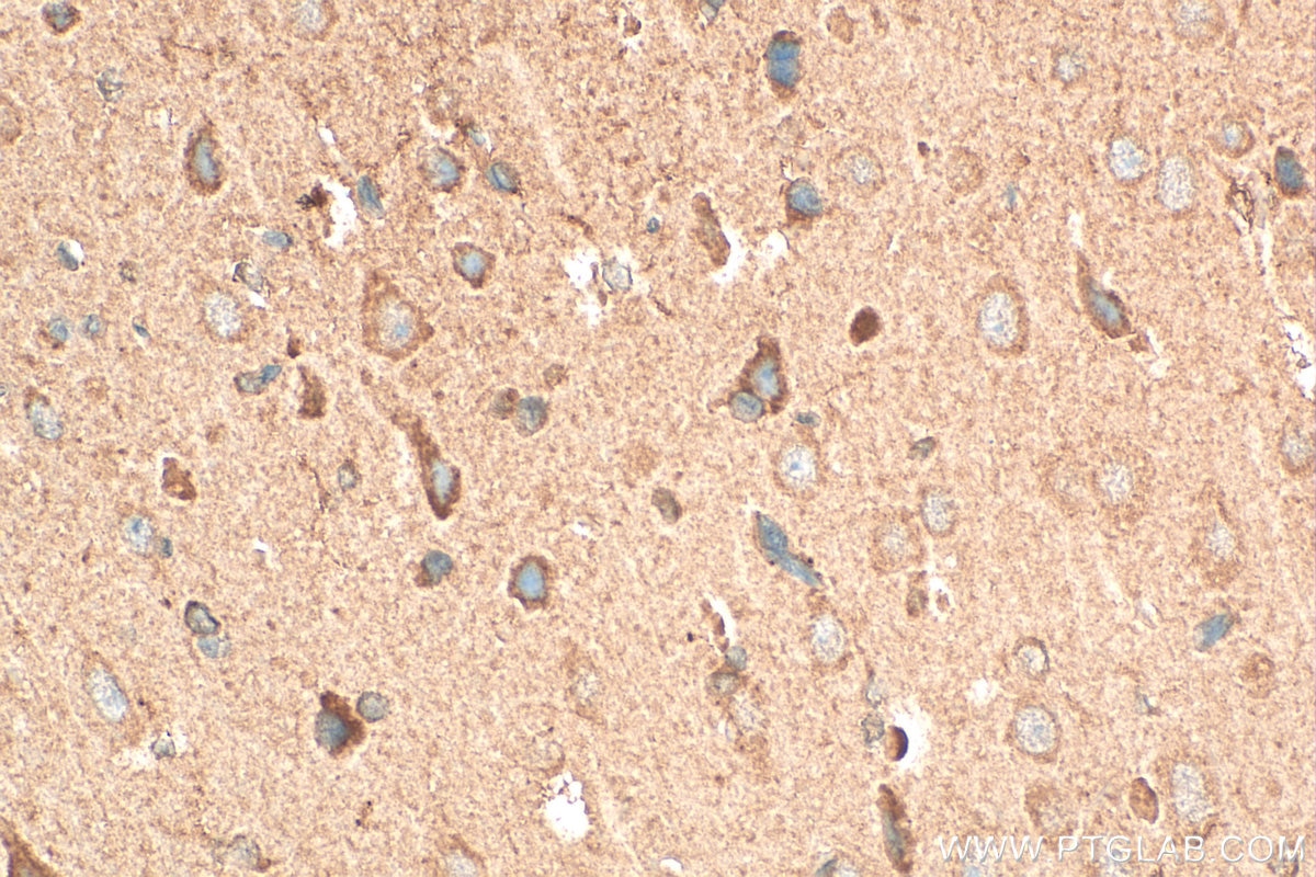 Immunohistochemical analysis of paraffin-embedded rat brain tissue slide using 28214-1-AP (BNP antibody) at dilution of 1:200 (under 40x lens). Heat mediated antigen retrieval with Tris-EDTA buffer (pH 9.0). Immunohistochemistry (IHC) staining of rat brain tissue using NPPB Polyclonal antibody (28214-1-AP)