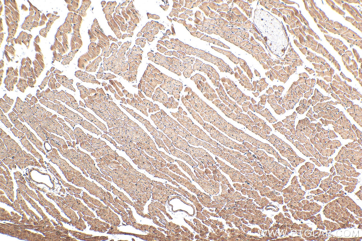 Immunohistochemical analysis of paraffin-embedded mouse heart tissue slide using 28214-1-AP (BNP antibody) at dilution of 1:200 (under 10x lens). Heat mediated antigen retrieval with Tris-EDTA buffer (pH 9.0). Immunohistochemistry (IHC) staining of mouse heart tissue using NPPB Polyclonal antibody (28214-1-AP)