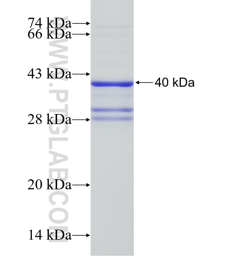 BNP fusion protein Ag4039 SDS-PAGE