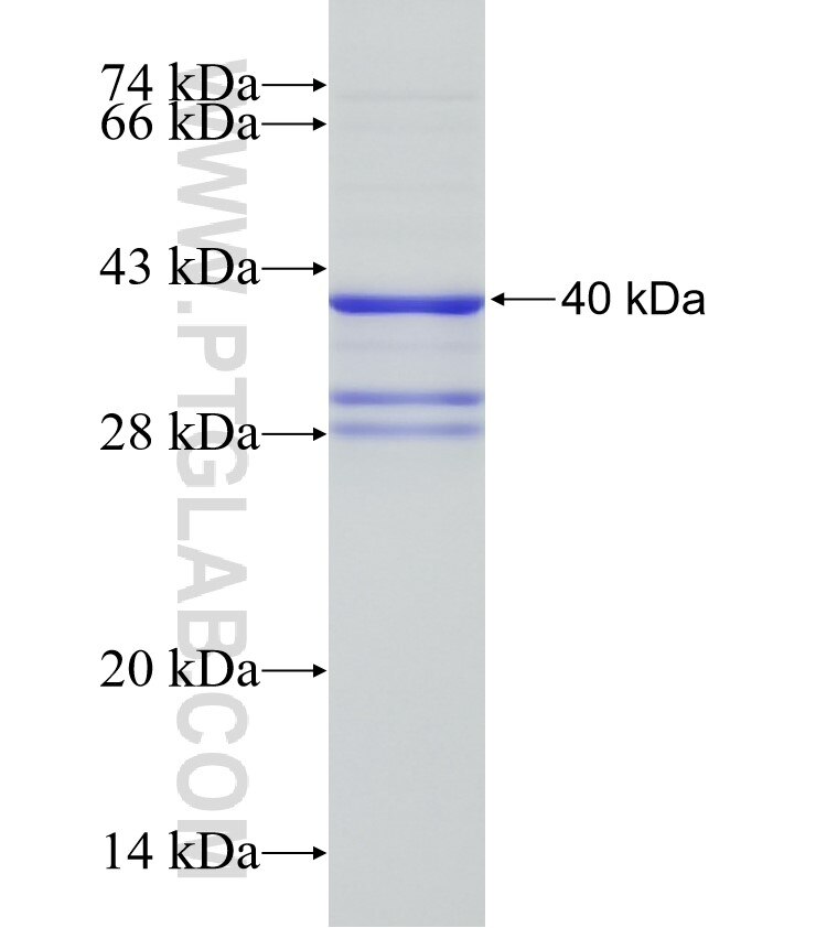 BNP fusion protein Ag4039 SDS-PAGE