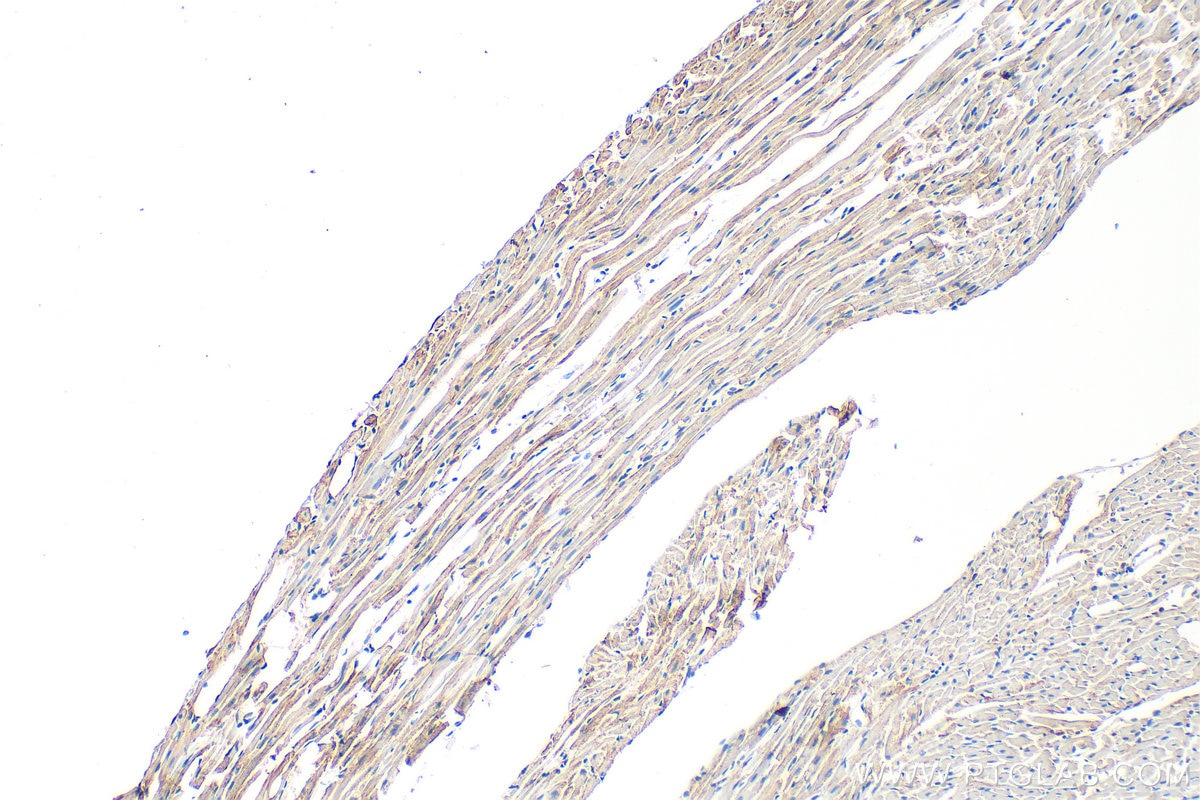 NPPC antibody (29352-1-AP) | Proteintech