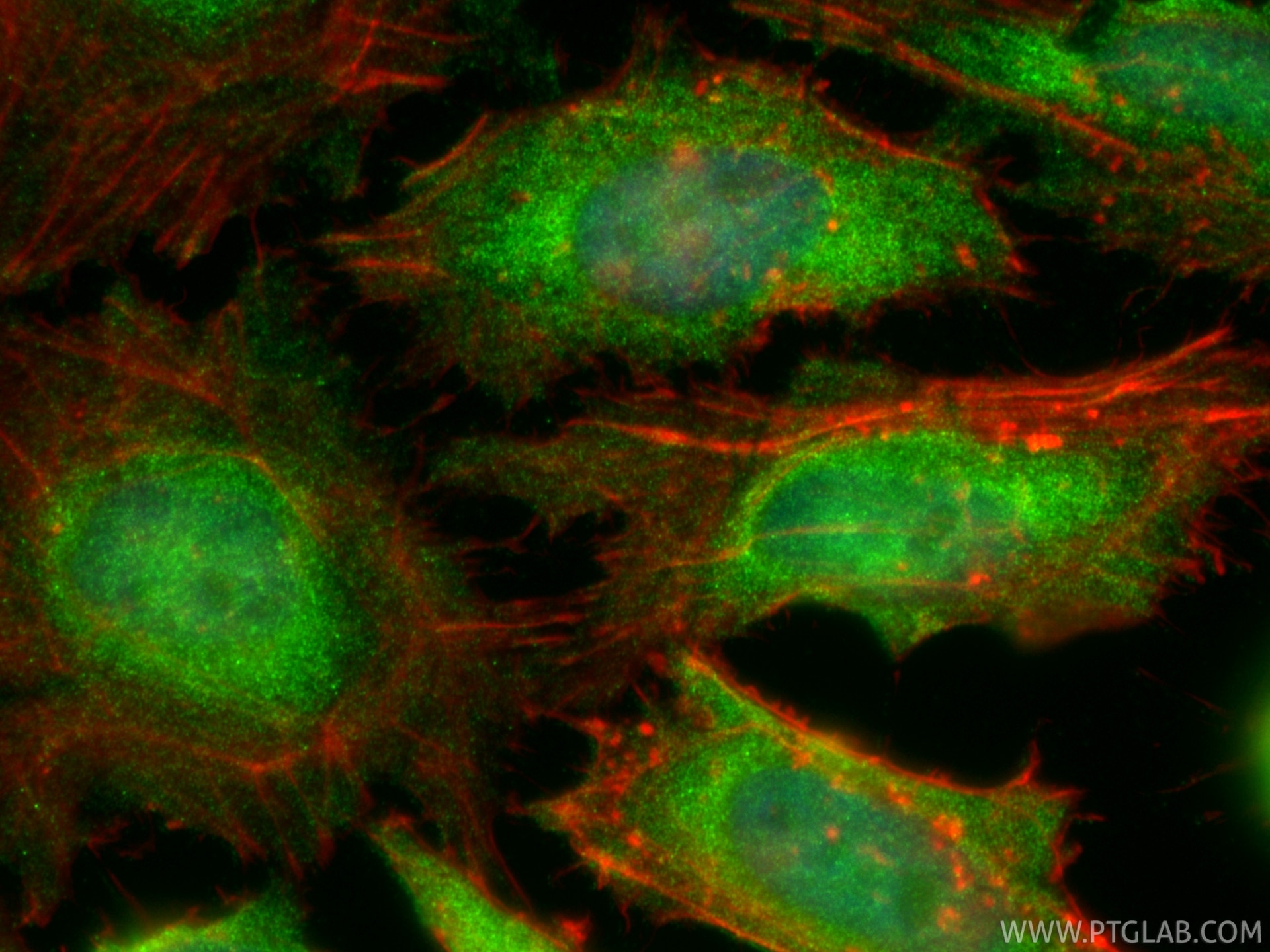 Immunofluorescence (IF) / fluorescent staining of HeLa cells using NPR1 Polyclonal antibody (55116-1-AP)