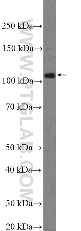 Western Blot (WB) analysis of SGC-7901 cells using NPR1 Polyclonal antibody (55116-1-AP)