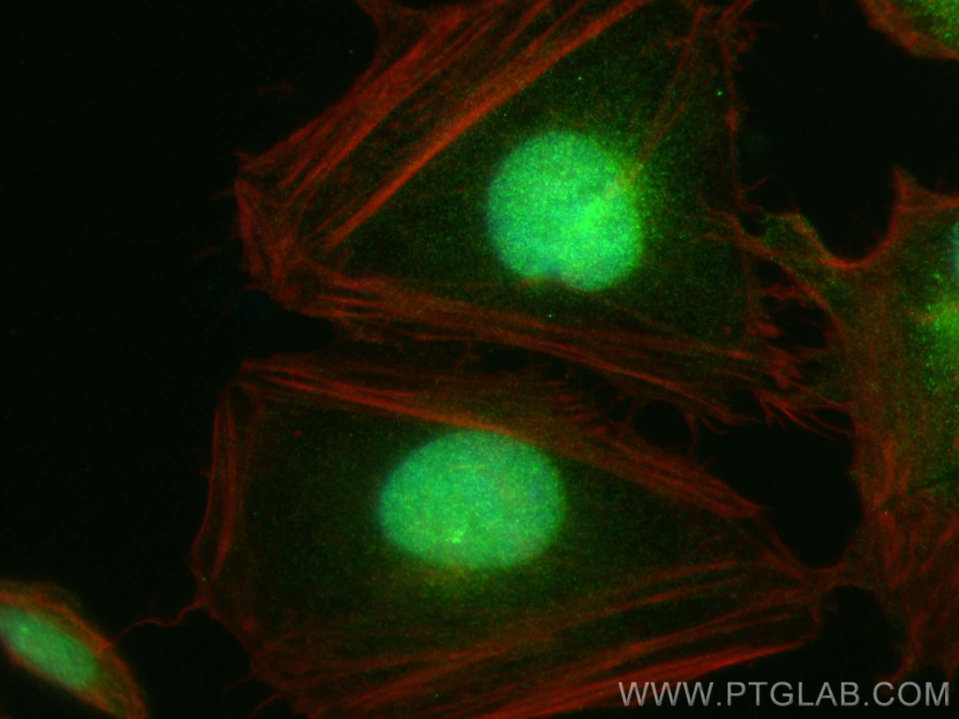 Immunofluorescence (IF) / fluorescent staining of HeLa cells using NPR1 Recombinant antibody (84043-1-RR)