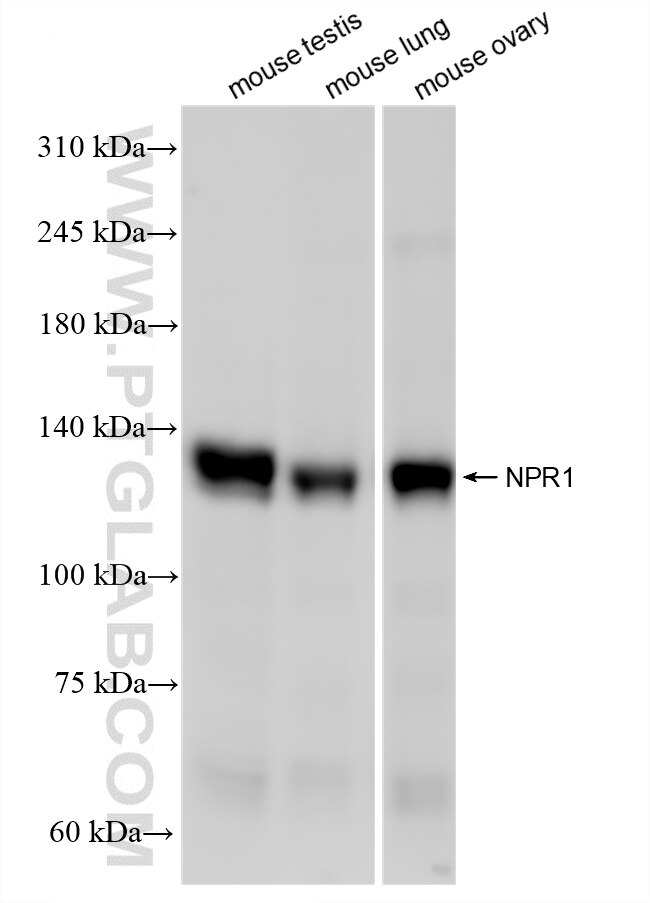 Western Blot (WB) analysis of various lysates using NPR1 Recombinant monoclonal antibody (87831-1-RR)