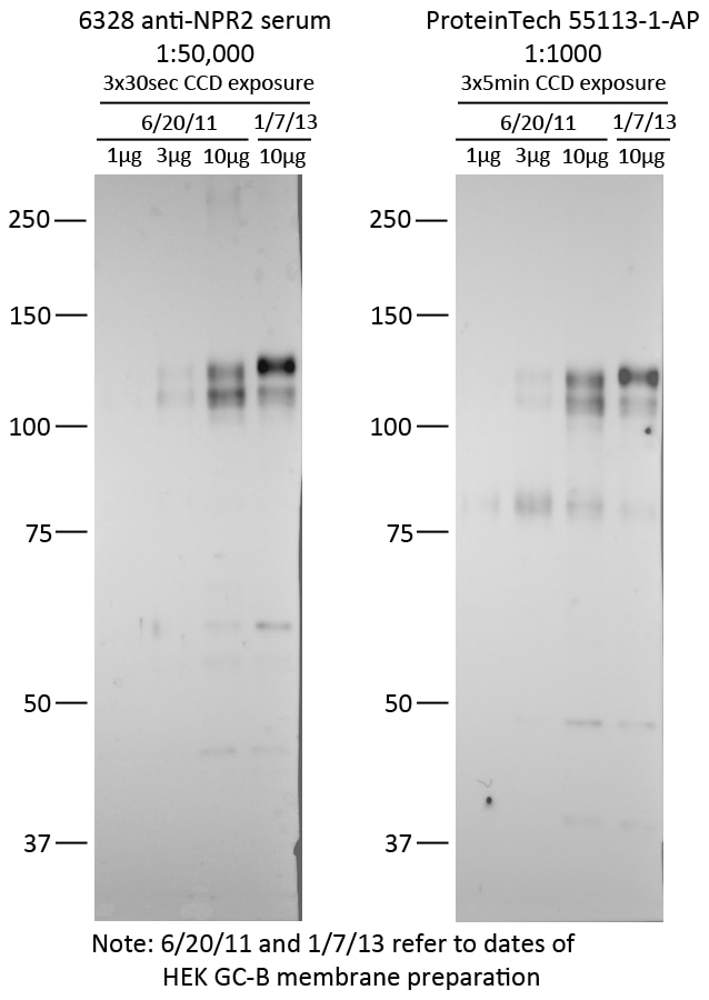 Western Blot (WB) analysis of transfected cells using NPR2 Polyclonal antibody (55113-1-AP)