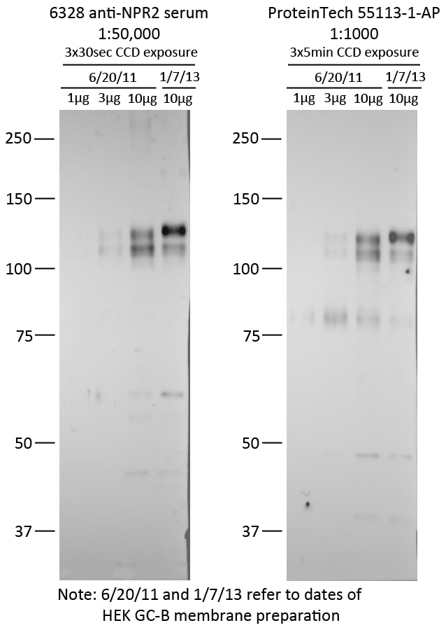 WB analysis of transfected cells using 55113-1-AP