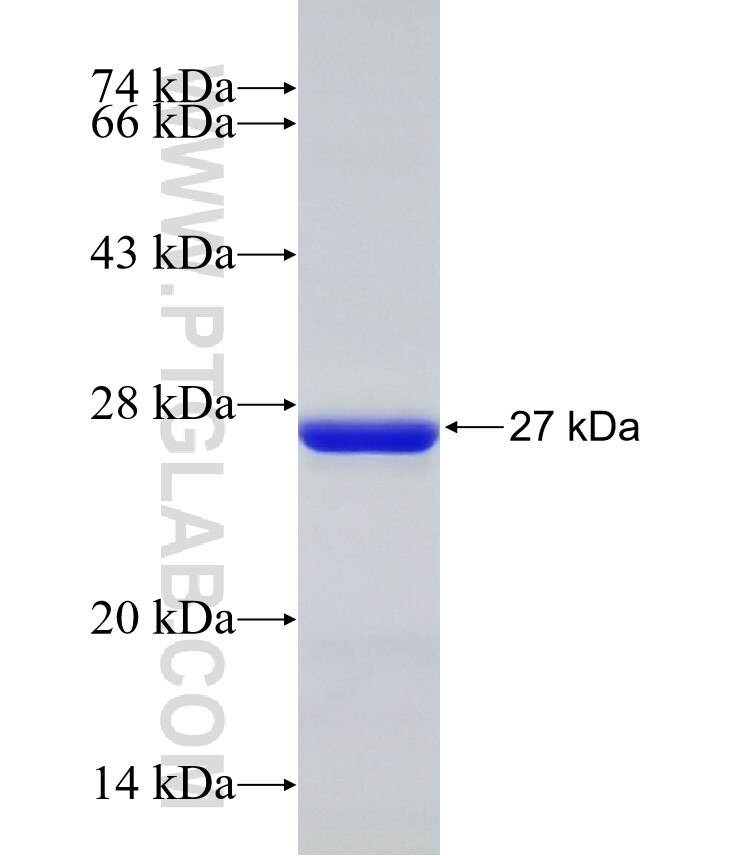 NPR2 fusion protein Ag32751 SDS-PAGE NPR2 fusion protein Ag32751 SDS-PAGE